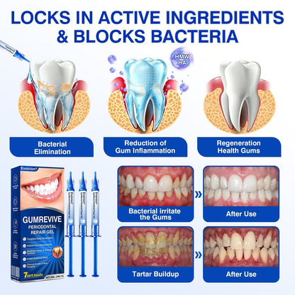 🇺🇸🏆🦷🛡️Evolvion® GumRevive Periodontal Repair Gel upsell - cikryna