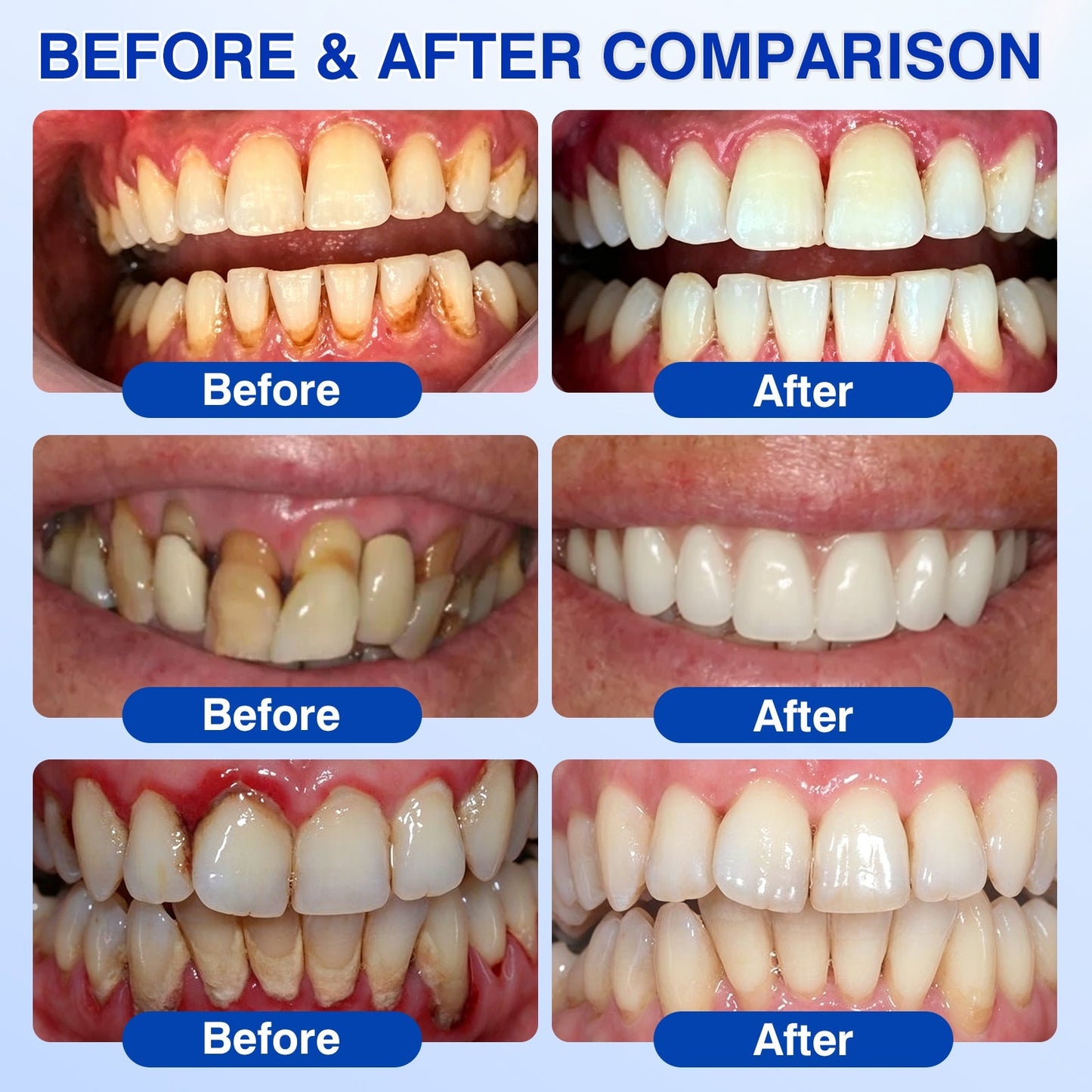 🇺🇸🏆🦷🛡️Evolvion® GumRevive Periodontal Repair Gel upsell - cikryna