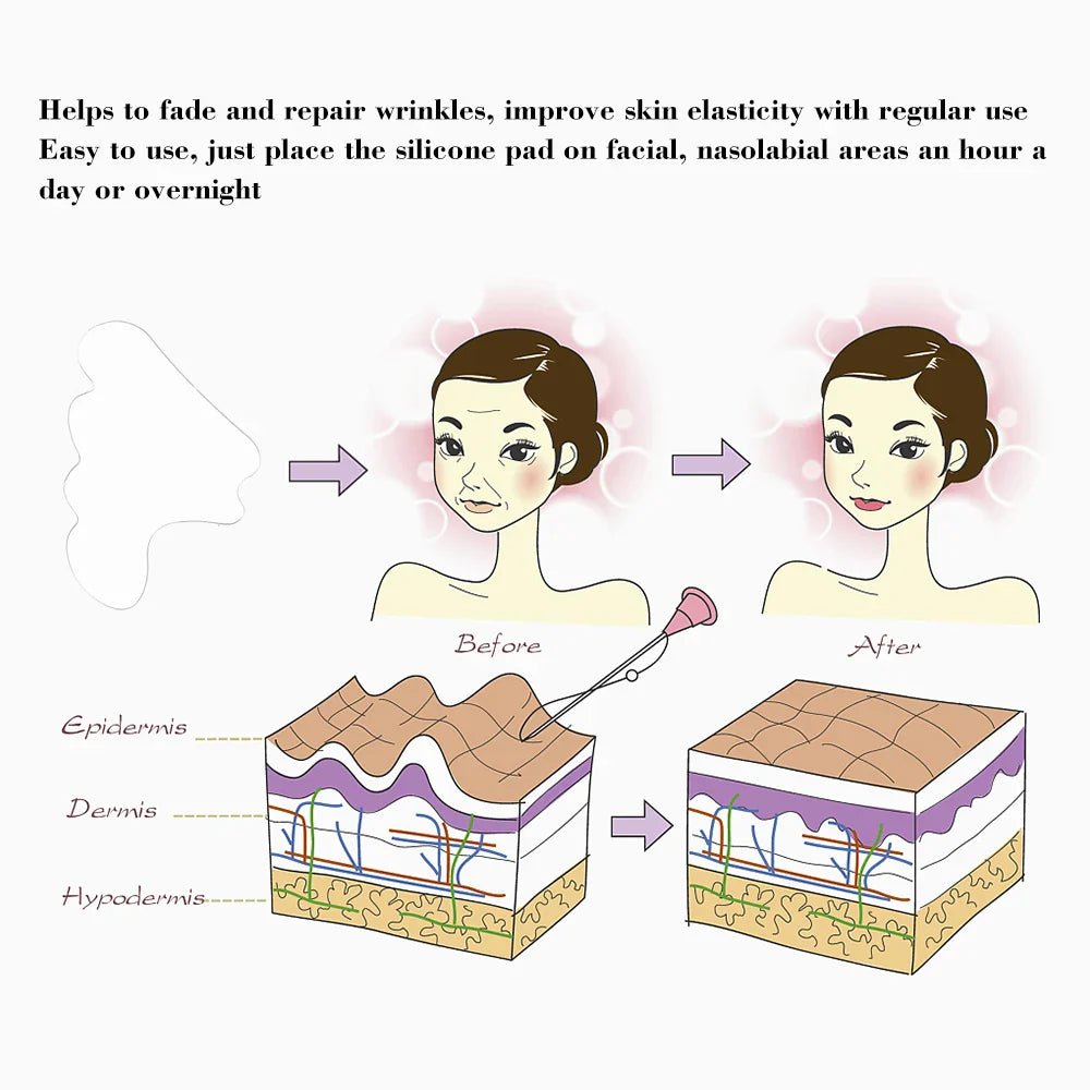 Facial Wrinkle Remover Pad Reusable Medical Grade Silicone Nasolabial Folds Anti - aging Mask Prevent Wrinkle Skin Lifting Patches - cikryna