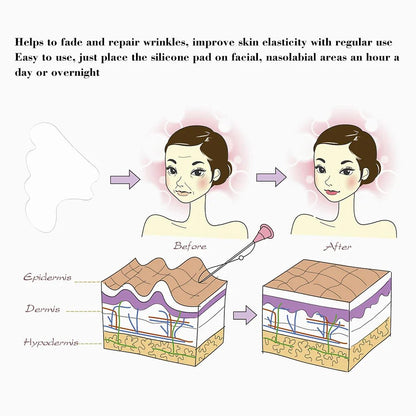 Facial Wrinkle Remover Pad Reusable Medical Grade Silicone Nasolabial Folds Anti - aging Mask Prevent Wrinkle Skin Lifting Patches - cikryna