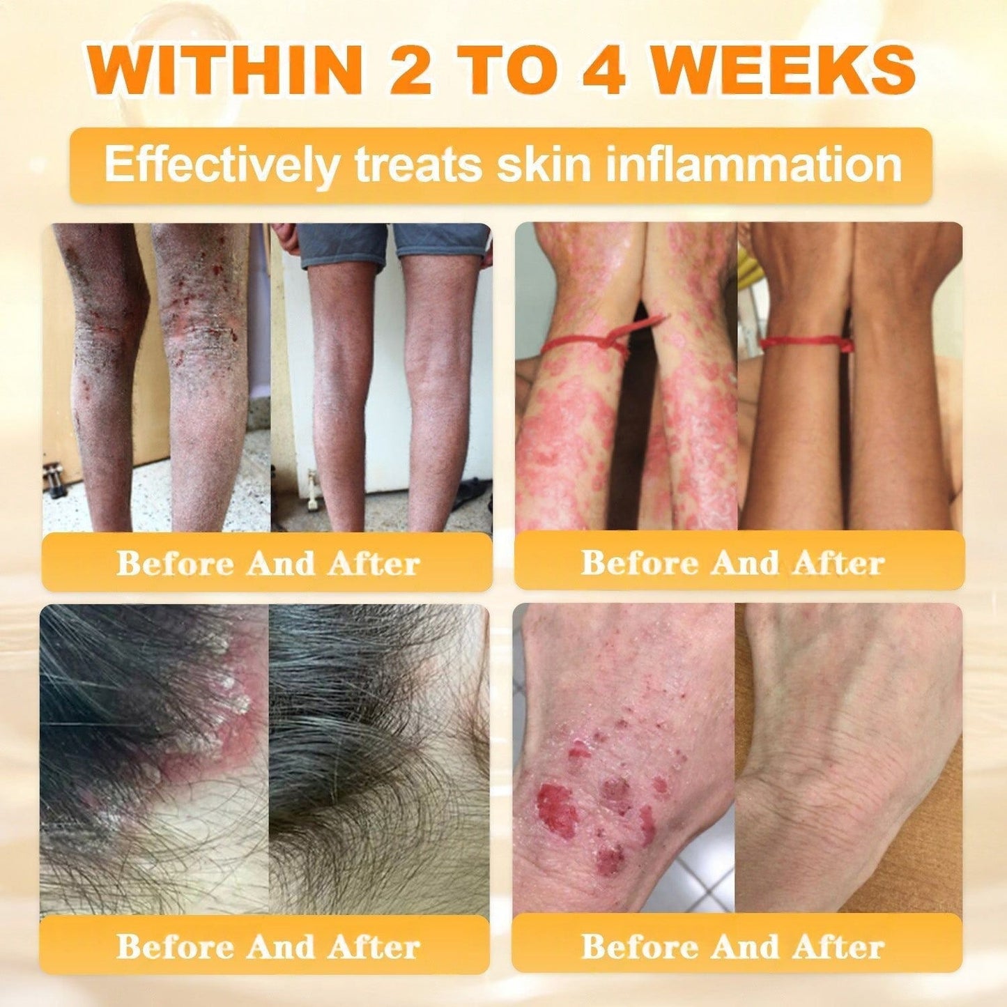 🐝💖FDA Approved|Rolimey® Bee Venom Skin Restoration Cream (Anti - aging, Hydrating, Skin Repair, Even Tone, Acne and Dark Spot Treatment, Wart and Mole Removal, Psoriasis Relief) - cikryna