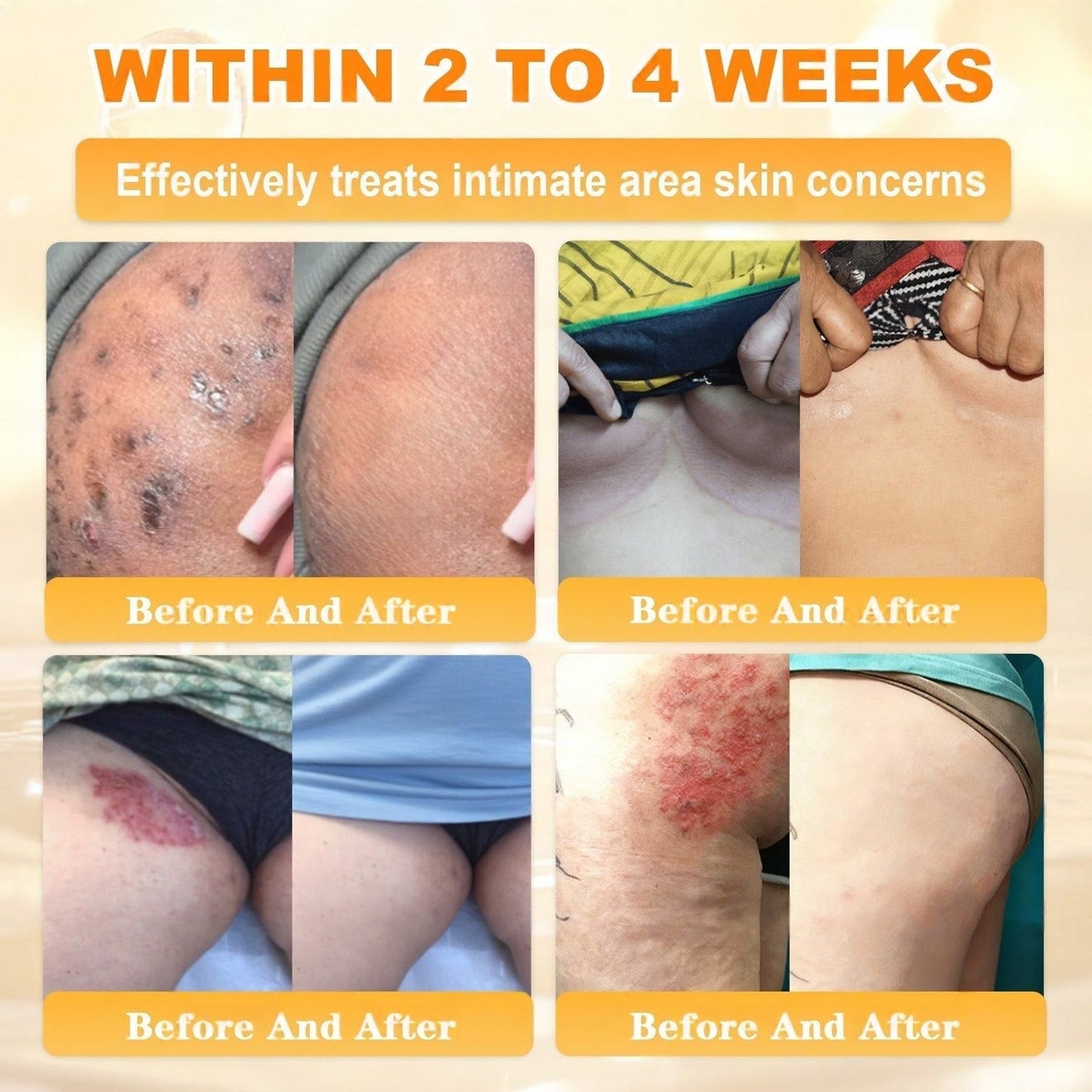 🐝💖FDA Approved|Rolimey® Bee Venom Skin Restoration Cream (Anti - aging, Hydrating, Skin Repair, Even Tone, Acne and Dark Spot Treatment, Wart and Mole Removal, Psoriasis Relief) - cikryna