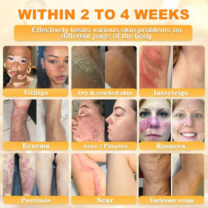 🐝💖FDA Approved|Rolimey® Bee Venom Skin Restoration Cream (Anti - aging, Hydrating, Skin Repair, Even Tone, Acne and Dark Spot Treatment, Wart and Mole Removal, Psoriasis Relief) - cikryna