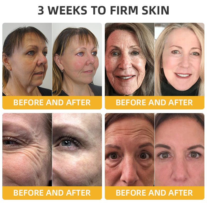 💐🥇Flysmus™ BeeLift Anti - Aging Firming Cream,Address Crepe & Sagging(🔥74% Off for a Limited Time!) - cikryna