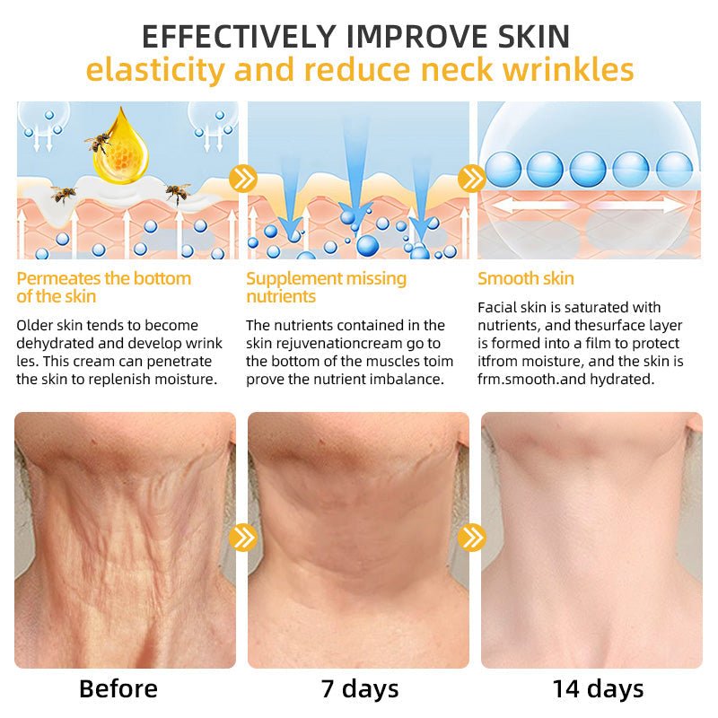 💐🥇Flysmus™ BeeLift Anti - Aging Firming Cream,Address Crepe & Sagging(🔥74% Off for a Limited Time!) - cikryna
