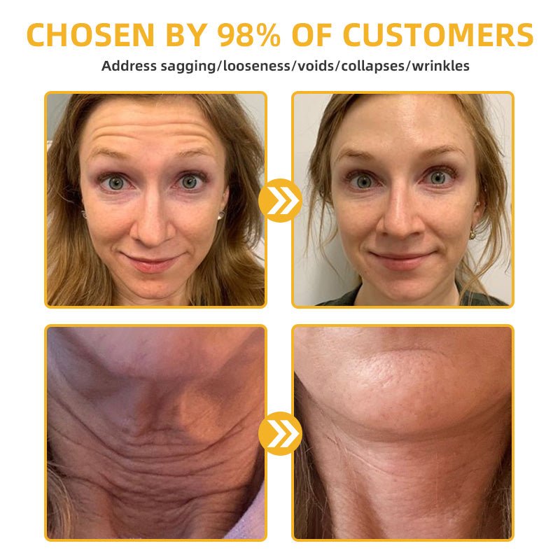 💐🥇Flysmus™ BeeLift Anti - Aging Firming Cream,Address Crepe & Sagging(🔥74% Off for a Limited Time!) - cikryna