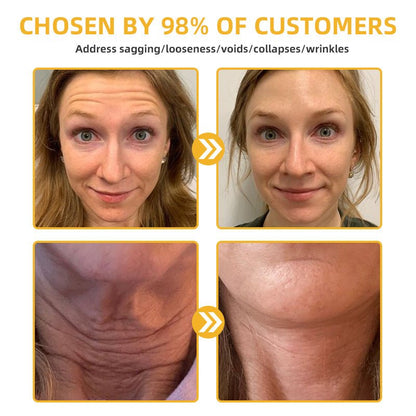 💐🥇Flysmus™ BeeLift Anti - Aging Firming Cream,Address Crepe & Sagging(🔥74% Off for a Limited Time!) - cikryna