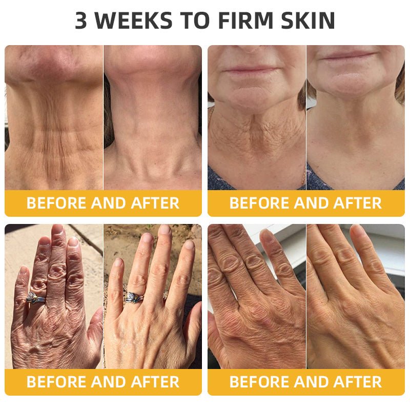 💐🥇Flysmus™ BeeLift Anti - Aging Firming Cream,Address Crepe & Sagging(🔥74% Off for a Limited Time!) - cikryna