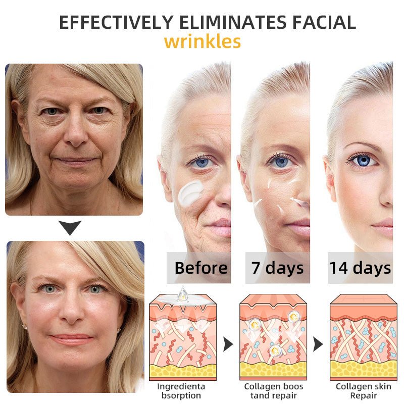 💐🥇Flysmus™ BeeLift Anti - Aging Firming Cream,Address Crepe & Sagging(🔥74% Off for a Limited Time!) - cikryna