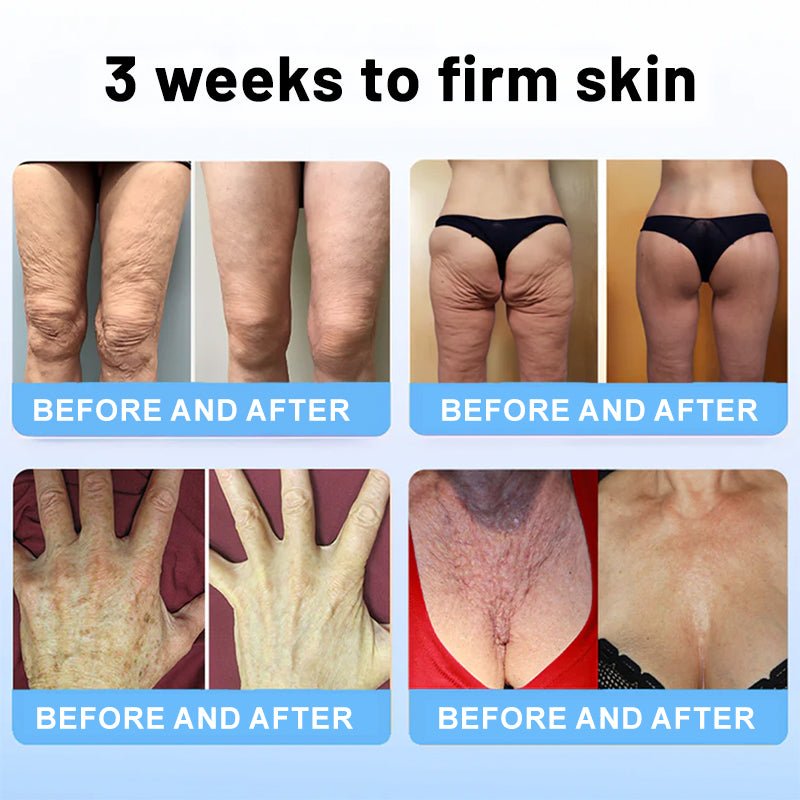 🔥🥔Flysmus™ Collagen Peptides FIRMING SERUM - cikryna