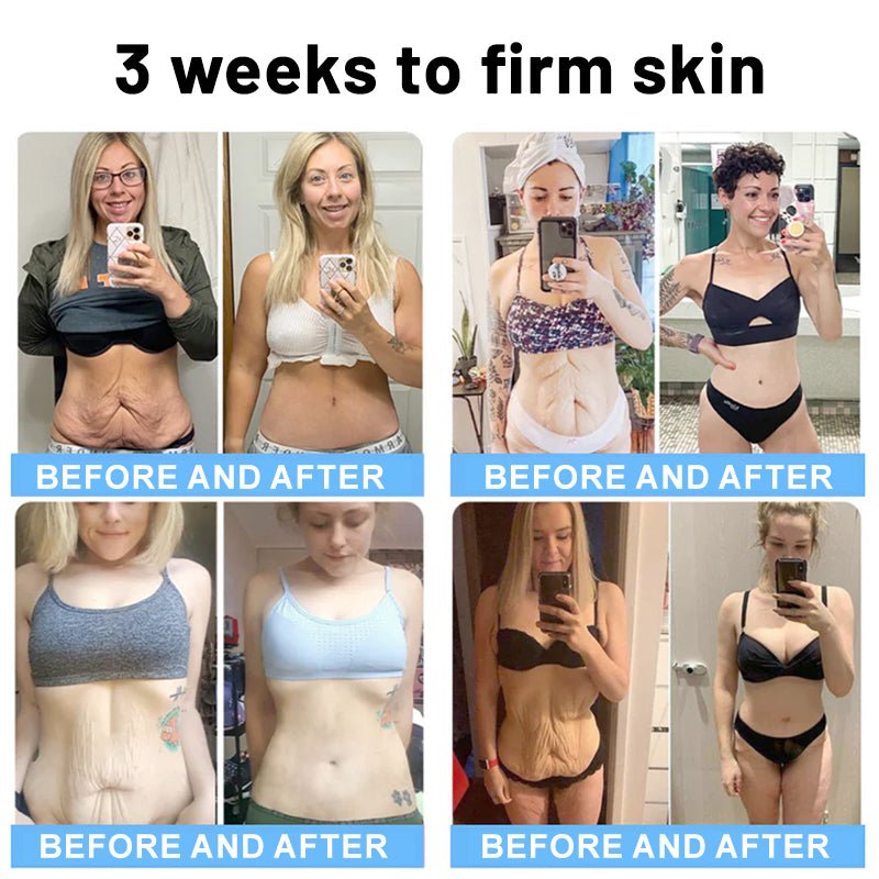 🔥🥔Flysmus™ Collagen Peptides FIRMING SERUM - cikryna