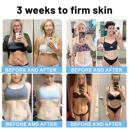 🔥🥔Flysmus™ Collagen Peptides FIRMING SERUM - cikryna