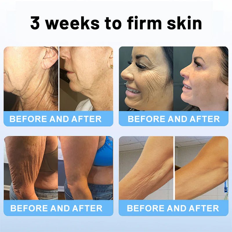 🔥🥔Flysmus™ Collagen Peptides FIRMING SERUM - cikryna