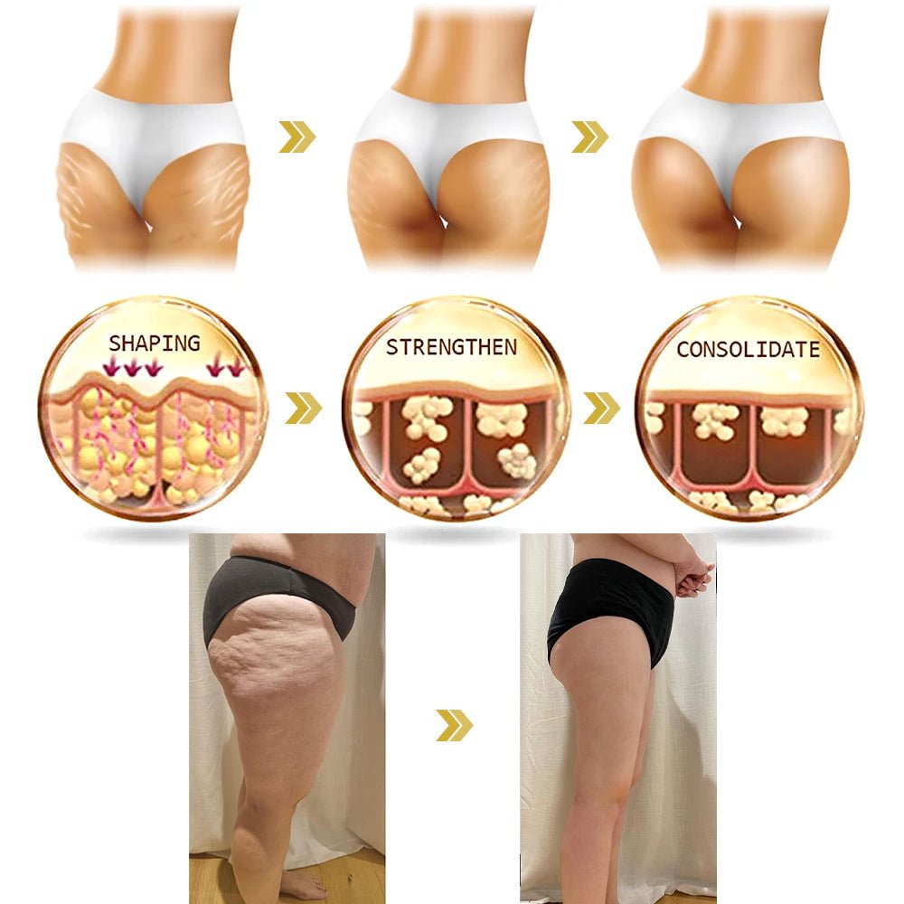 ✨💖Flysmus® Skin Firming Cream,Addressing Crepe ＆ Sagging - cikryna