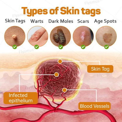 Flysmus® Tag Recede Bee Venom Treatment Cream - LAST DAY 70% OFF - Maximize Skin Renewal - cikryna