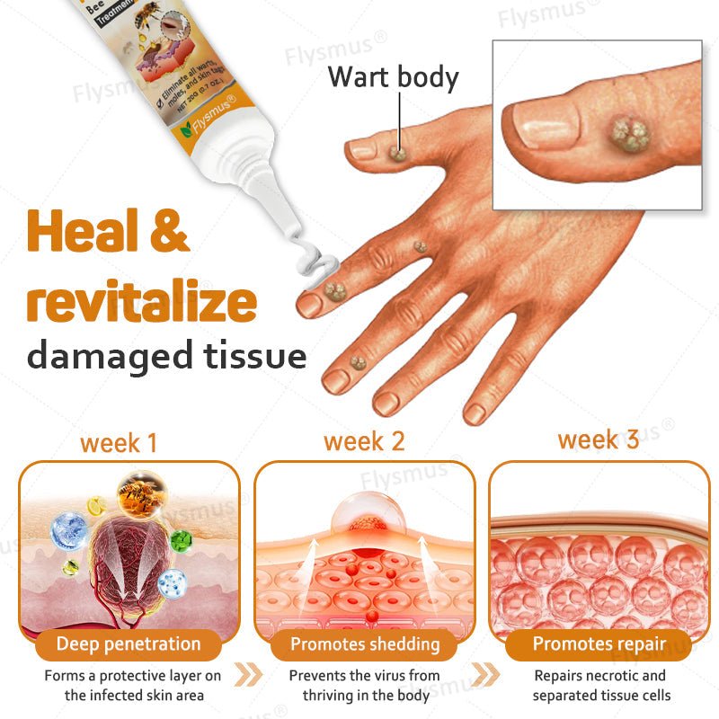 Flysmus® Tag Recede Bee Venom Treatment Cream - LAST DAY 70% OFF - Maximize Skin Renewal - cikryna