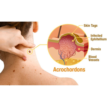 flysmus™ TagRecede Bee Venom Treatment Spray - cikryna