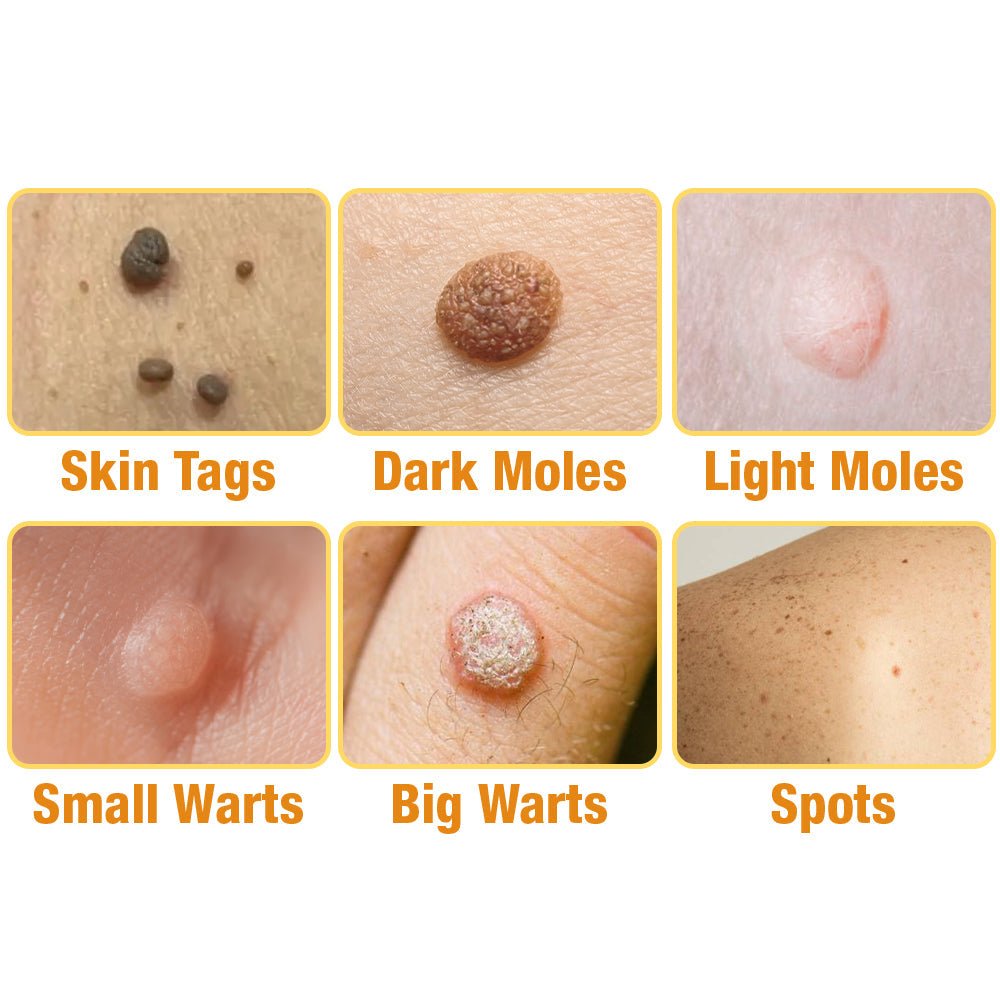 flysmus™ TagRecede Bee Venom Treatment Spray - cikryna