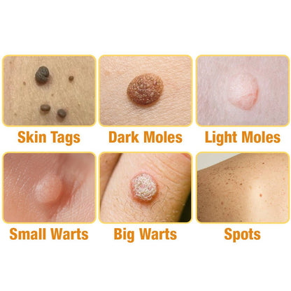 flysmus™ TagRecede Bee Venom Treatment Spray - cikryna