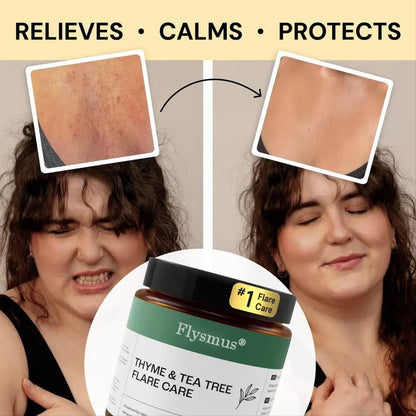 Flysmus®Tea Tree Flare Care| Cystic Acne and Bumps Treatment Skincare Daily Pimple - cikryna