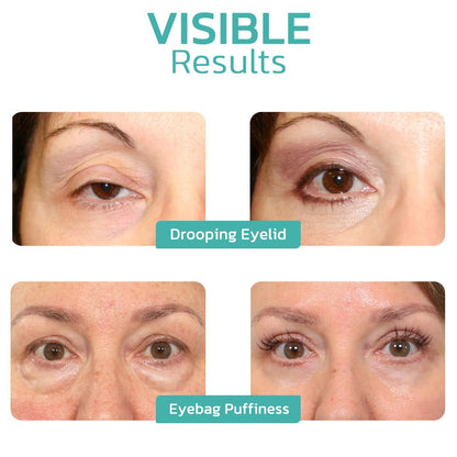 Furzero™ CELYN Peptide Taut Eye Cream - cikryna