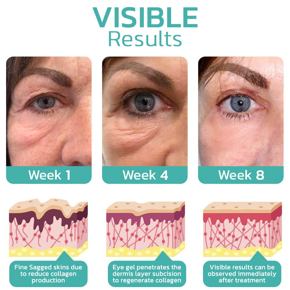 Furzero™ CELYN Peptide Taut Eye Cream - cikryna