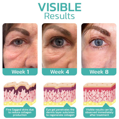 Furzero™ CELYN Peptide Taut Eye Cream - cikryna