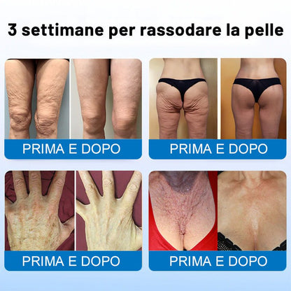 ✨✨Furzero® Oligopeptide - Infused Skin Firming Cream - cikryna