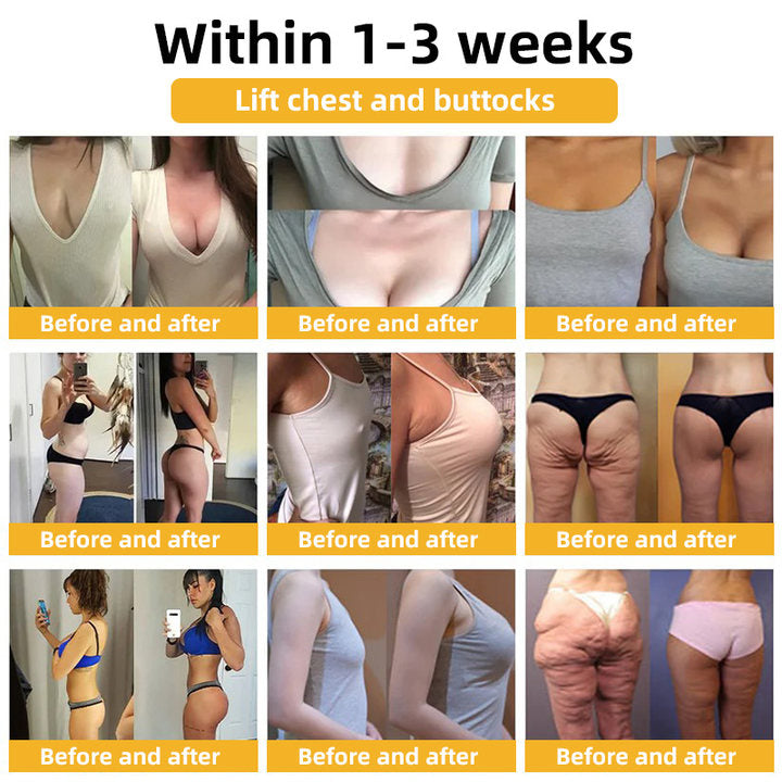 💐🥇Flysmus™ BeeLift Anti-Aging Firming Cream,Address Crepe & Sagging(🔥74% Off for a Limited Time!)