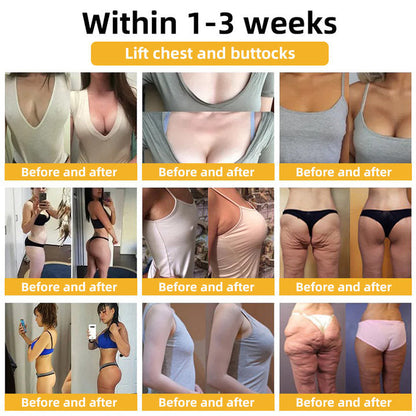 💐🥇Flysmus™ BeeLift Anti-Aging Firming Cream,Address Crepe & Sagging(🔥74% Off for a Limited Time!)