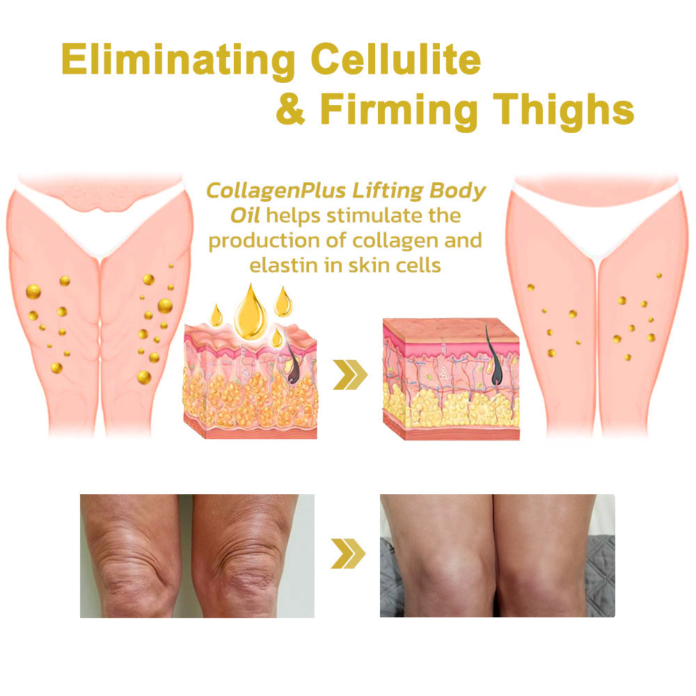 ✨💖Flysmus® Skin Firming Cream,Addressing  Crepe ＆ Sagging