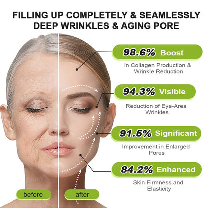 🍋Made and shipped from the USA 💫Rolimey® Botox & Vita - A Retinol Shot Wrinkle - Lift Tightening cream - Last Day Promotion 70% OFF - cikryna