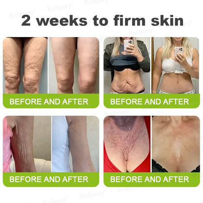 🍋Made and shipped from the USA 💫Rolimey® Botox & Vita - A Retinol Shot Wrinkle - Lift Tightening cream - Last Day Promotion 70% OFF - cikryna