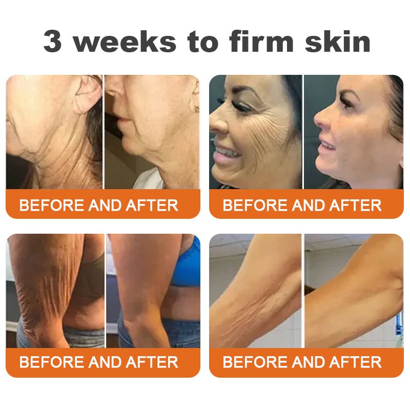 💫👨‍⚕️🐬Made and Shipped from the USA✨Flysmus™ Botox Bee Venom Firming Serum Stick🔥LAST DAY 70% OFF - cikryna