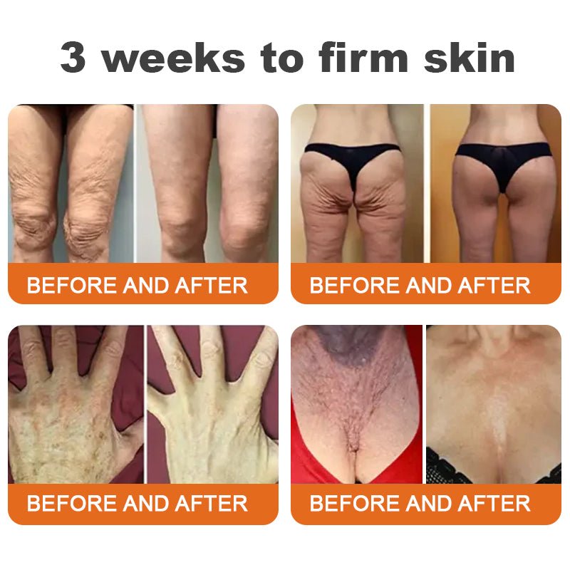 💫👨‍⚕️🐬Made and Shipped from the USA✨Flysmus™ Botox Bee Venom Firming Serum Stick🔥LAST DAY 70% OFF - cikryna