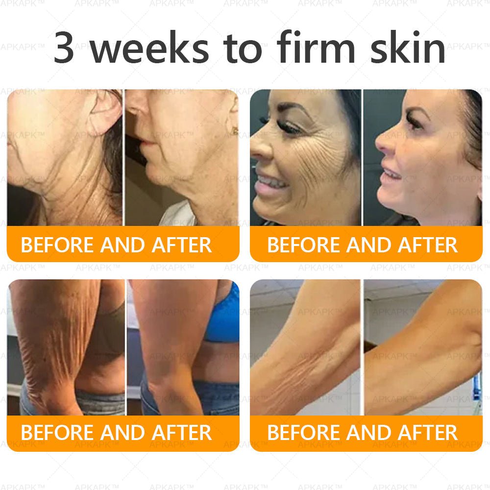 Made and Shipped from USA 💎 APKAPK® Bee venom Comprehensive Cream 🔥 LAST DAY 80% OFF 💎 - cikryna