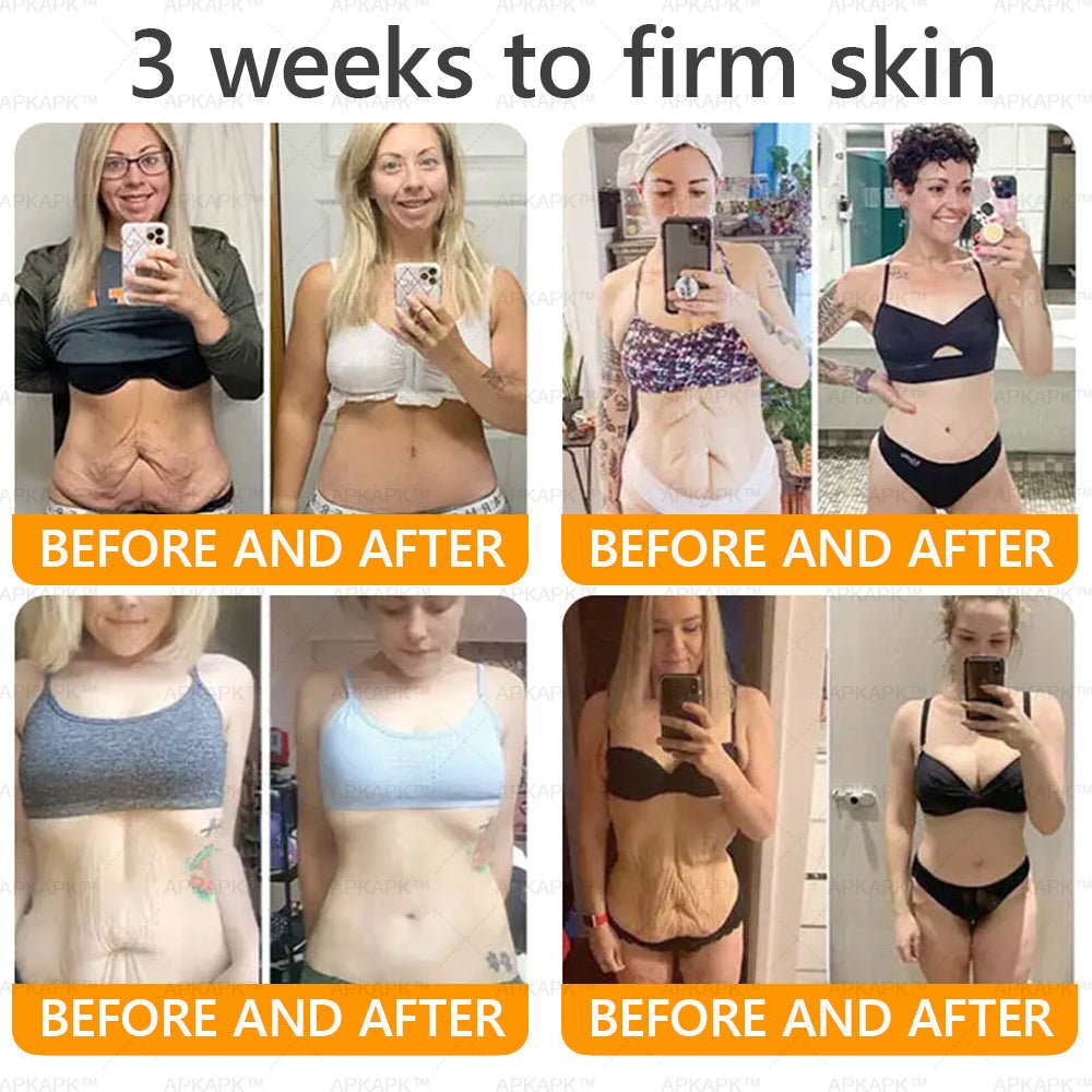 Made and Shipped from USA 💎 APKAPK® Bee venom Comprehensive Cream 🔥 LAST DAY 80% OFF 💎 - cikryna