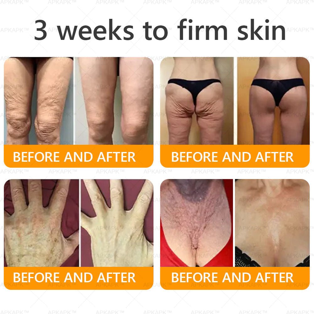 Made and Shipped from USA 💎 APKAPK® Bee venom Comprehensive Cream 🔥 LAST DAY 80% OFF 💎 - cikryna