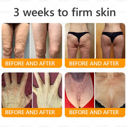 Made and Shipped from USA 💎 APKAPK® Bee venom Comprehensive Cream 🔥 LAST DAY 80% OFF 💎 - cikryna