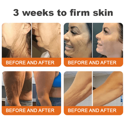 🐝Made and Shipped from USA👨‍⚕️Flysmus® AH - 8 Bee Venom Wrinkle Remove Roller Serum(🔥LAST DAY 70% OFF) - cikryna