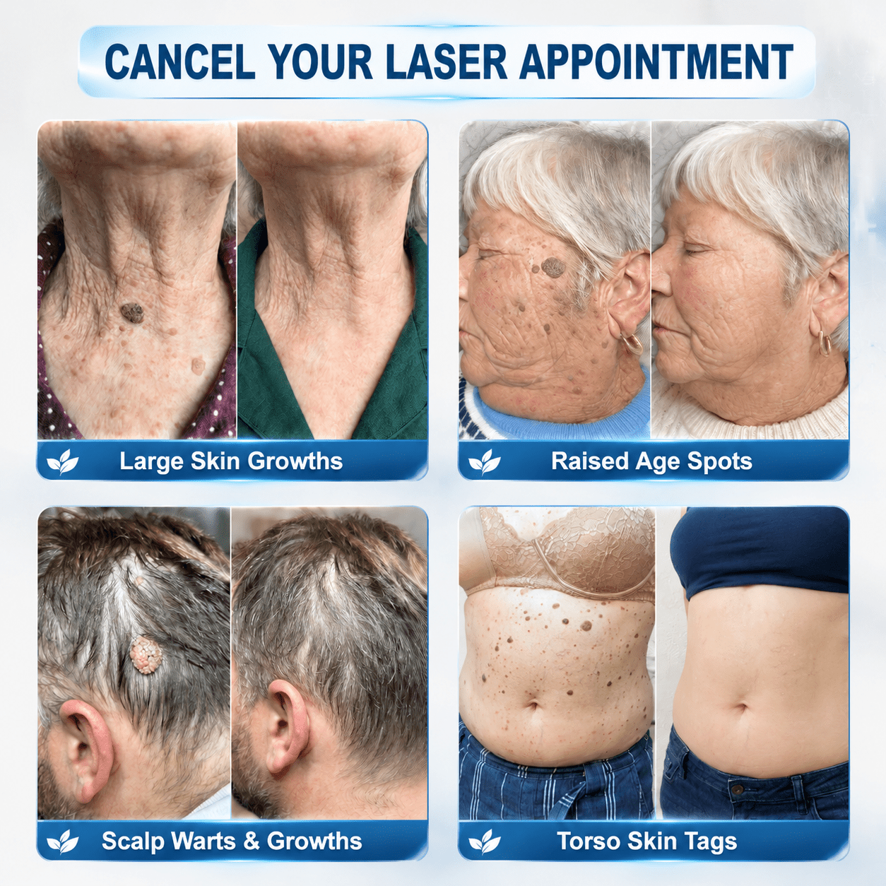 𝐎𝐟𝐟𝐢𝐜𝐢𝐚𝐥 𝐁𝐫𝐚𝐧𝐝 𝐒𝐭𝐨𝐫𝐞 |✅💎Remifa® 7-𝐷𝑎𝑦 𝗧𝐚𝐠 & 𝗦𝗽𝐨𝐭 𝐄𝐫𝒂𝒔𝒆𝒓(Zero Pain, Zero 𝐒𝐜𝐚𝒓𝒔 Rollerball) upsell - cikryna