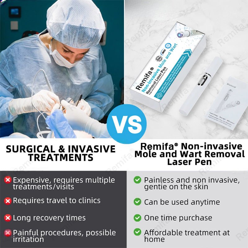 REMIFA® N𝐨n - inv𝐚siv𝐞 𝐌𝐨l𝐞 and W𝐚rt 𝐑𝐞m𝐨v𝐚l L𝐚s𝐞r 𝐏𝐞n 𝐏r𝐨m𝐚x upsell - cikryna