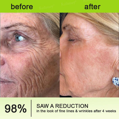 Rolimey® Botox & Vita - A Retinol Shot Wrinkle - Lift Tightening cream - Last Day Promotion 70% OFF - cikryna